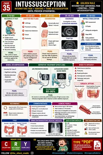 One-pager preview: Intussusception: Approach